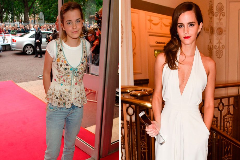 Emma Watson In Her Teens Later Transformed Into A Fashion Icon