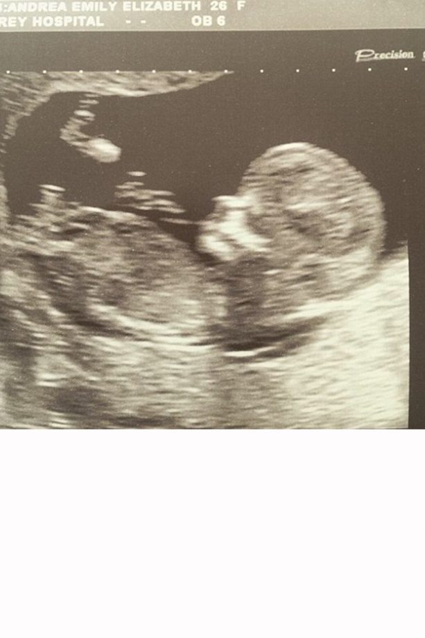 Peter Andre Confirms That Wife Emily MacDonagh Is Pregnant With Their Second Child Via This Cute Baby Scan, 2016
