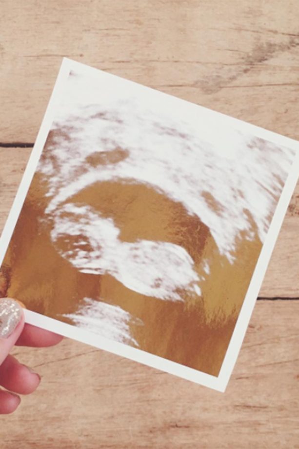 Lauren Conrad pregnant
